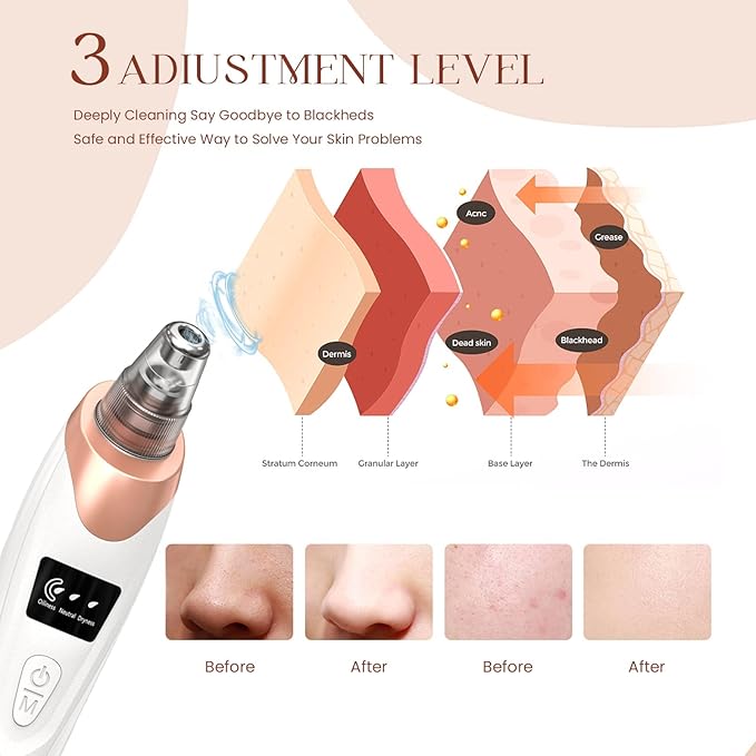 Blackhead Remover | Electric Vacuum Pore Cleaner USB Rechargeable for Face & Acne Care